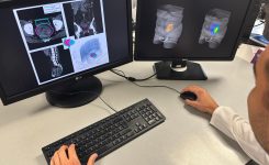 30 de juny de 2025 | Ivace+i finança un projecte per a millorar la precisió dels tractaments de radioteràpia que combaten el càncer