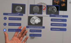 Ivace+i Innovació recolza el desenrotllament d’una plataforma de realitat augmentada per a assistir als equips de neurocirurgia en les seues intervencions